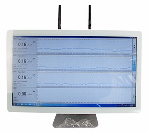 空气中微量铀的测定方法激光荧光法GB12377-1990