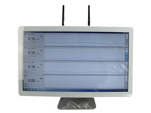 放射事故处理的一般原则是什么?